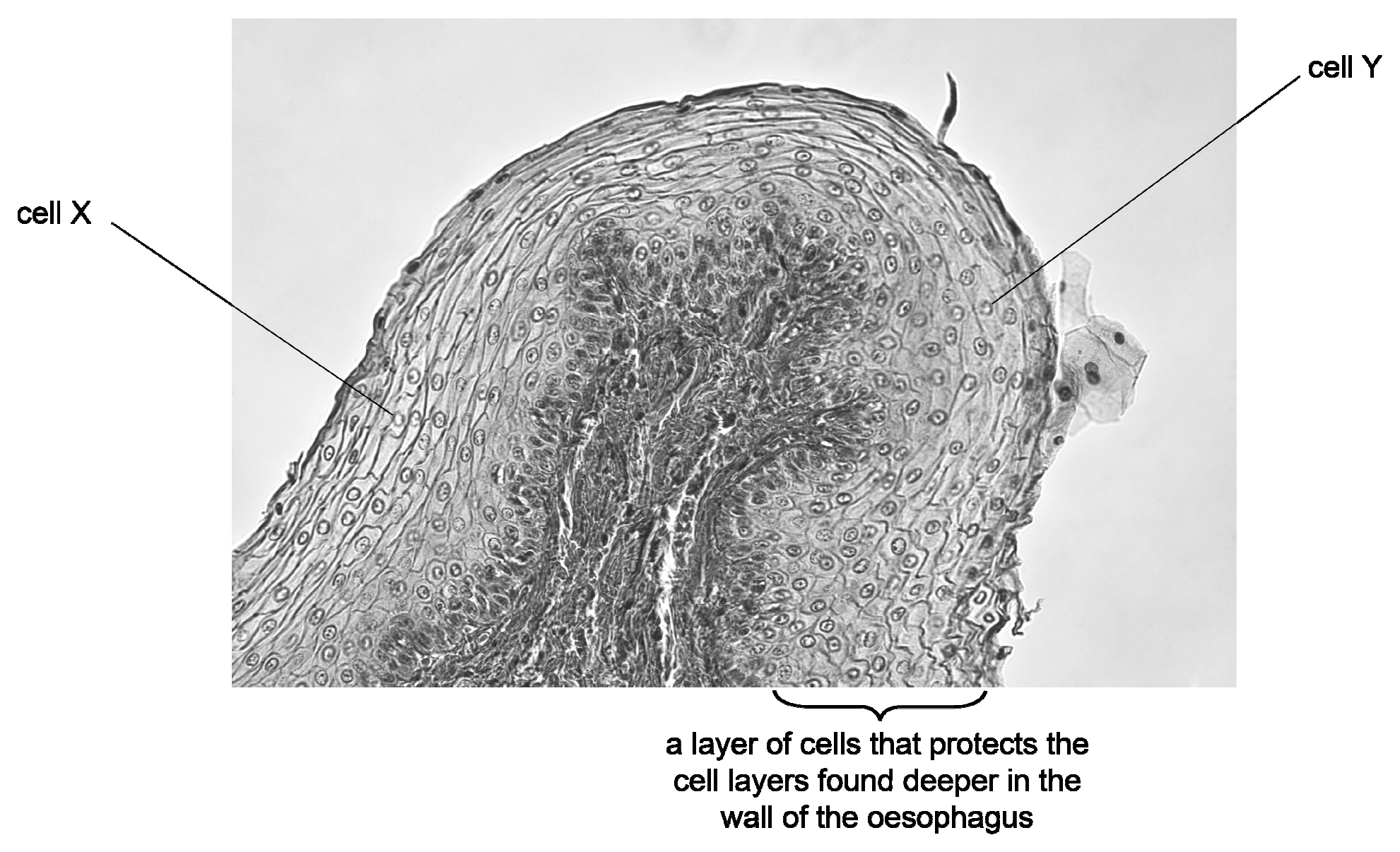 A light-microscope photograph of a section through part of the wall of the oesophagus: a rounded projection of tissue made of many layers of flattened cells with dark nuclei around a darker fibrous core. Cell X is labelled in the layered outer region on the left side and cell Y at the surface on the right side. A bracket under the lower right edge is labelled: a layer of cells that protects the cell layers found deeper in the wall of the oesophagus.